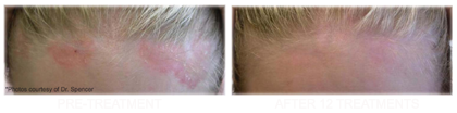 dermatologist in Philadelphia