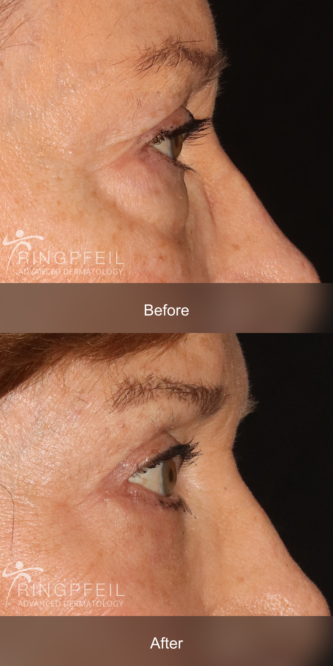 Catherine Smith before and after