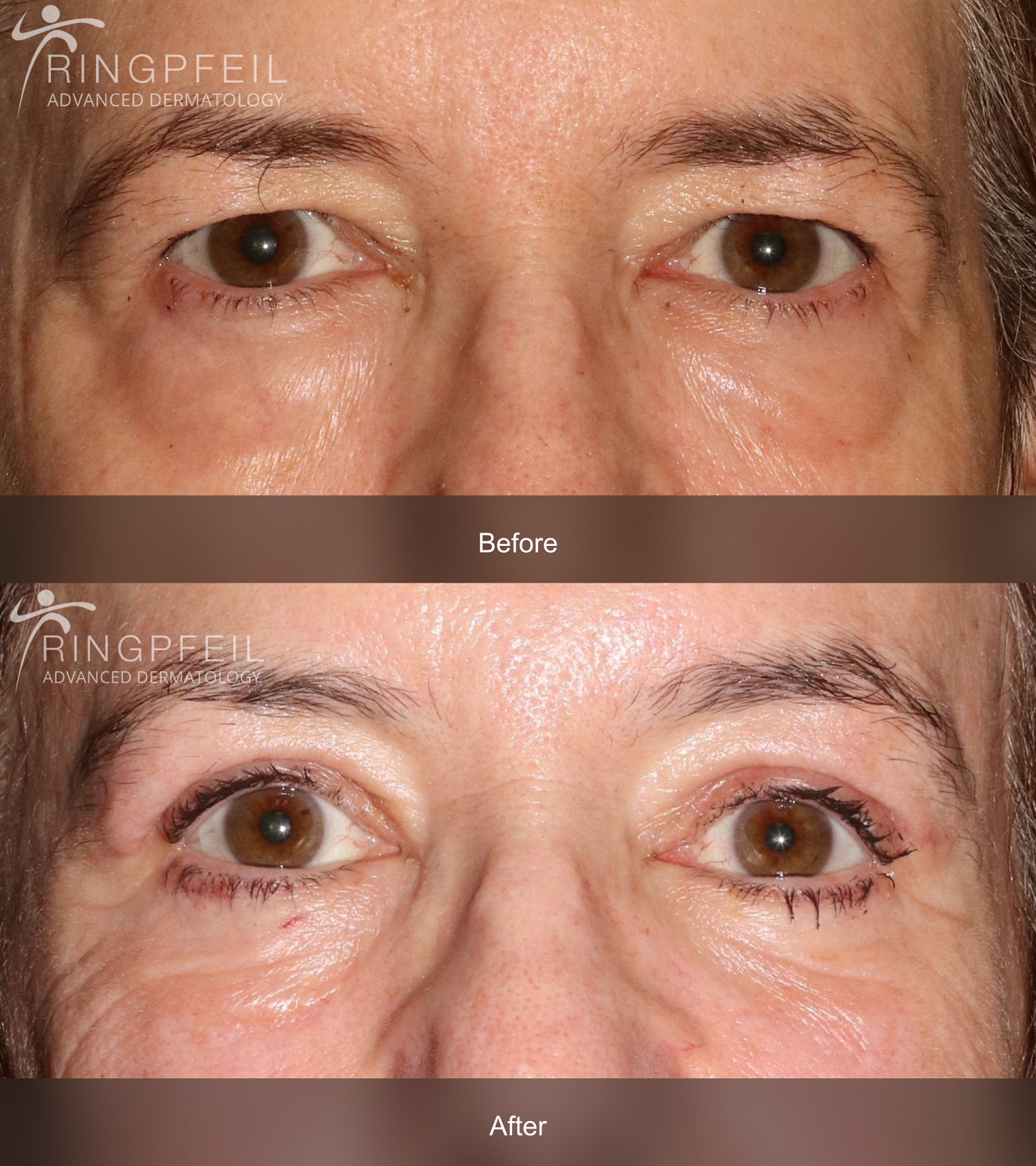 Julia Barol before and after