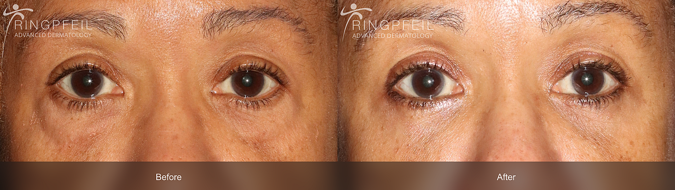 Renata Cobb before and after