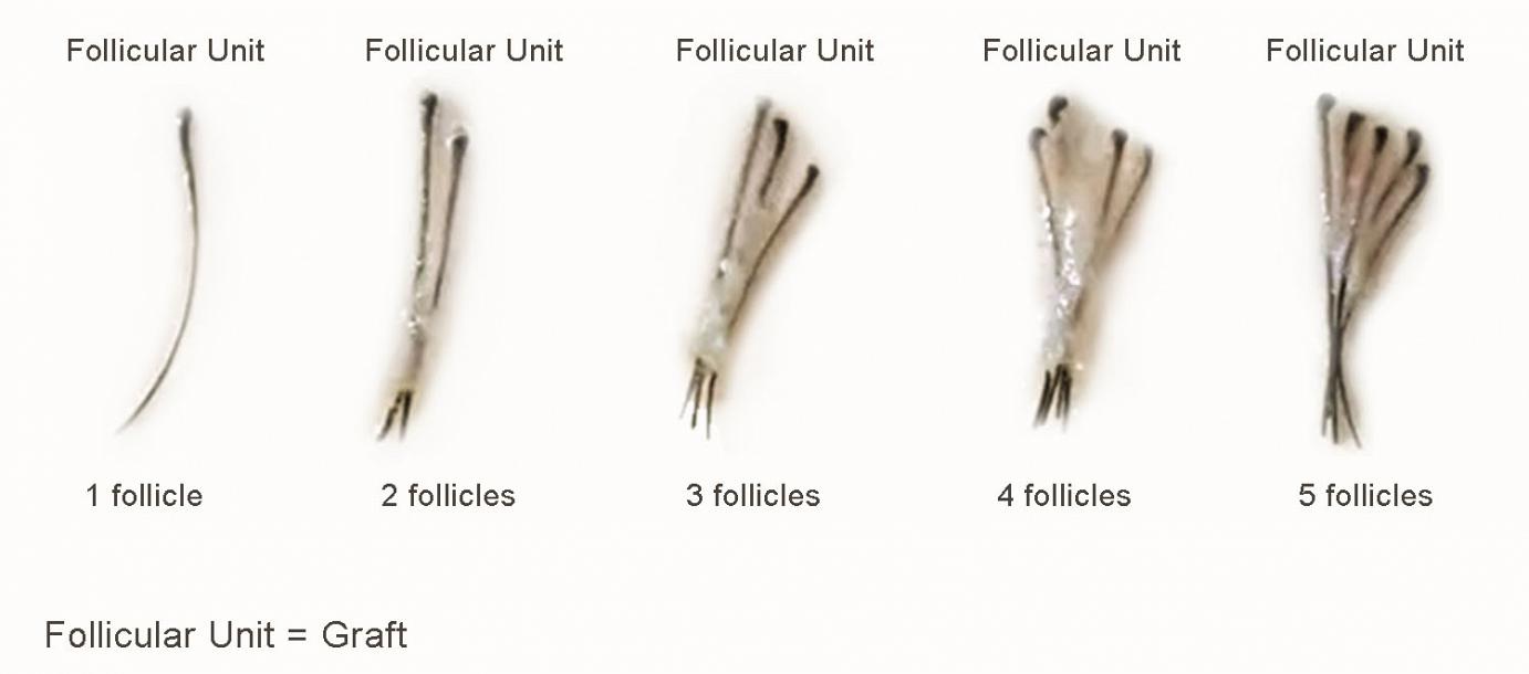 Follicular units