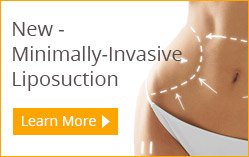 Skin Tightening Philadelphia Laser Surgery Main Line - Titan Laser Thermage  Laser