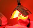 photodynamic therapy